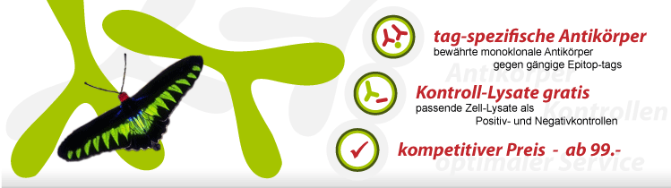 www.tag-tools.de the specialist for tag-specific antibodies and antibody related tools including positive and negative control lysates